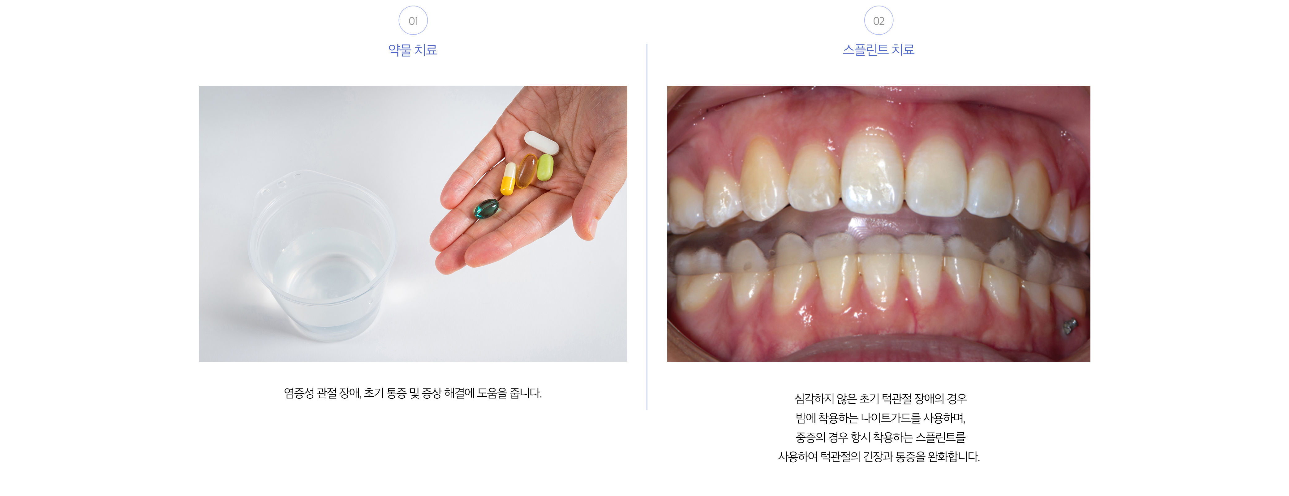 치료방법